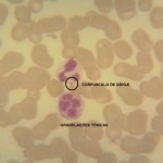 Foto da extensão sanguínea 4