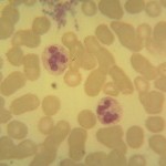 Foto da extensão sanguínea 3