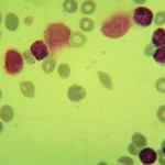 Foto da extensão sanguínea 2