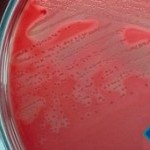 Cultura úlcera da perna