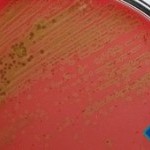 Cultura secreção pulmonar (escarro)