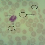 Foto da extensão sanguínea 3