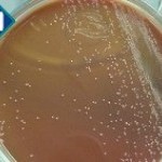 Imagem 1 - Crescimento no Ágar Sangue