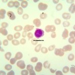 Foto da extensão sanguínea 11