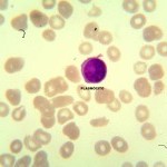 Foto da extensão sanguínea 6