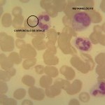 Foto da extensão sanguínea 6