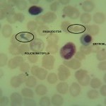 Foto da extensão sanguínea 4