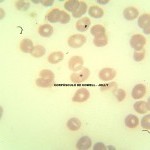 Foto da extensão sanguínea 8