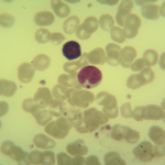 Foto da extensão sanguínea 3