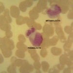 Foto da extensão sanguínea 7