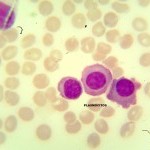 Foto da extensão sanguínea 9