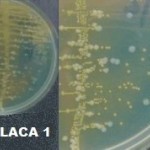 Imagem 1 - Urocultura - Amostra 1