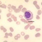 Foto da extensão sanguínea 5