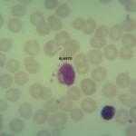 Foto da extensão sanguínea 5