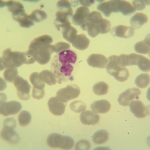 Foto da extensão sanguínea 2