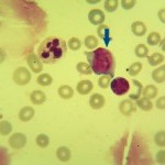 Foto da extensão sanguínea 3