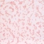 Imagem 2 - Coloração de gram