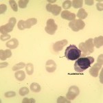 Foto da extensão sanguínea 2