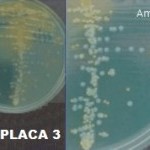 Imagem 3 - Urocultura - Amostra 3