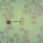 Foto da extensão sanguínea 2