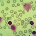 Foto da extensão sanguínea 5