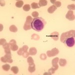 Foto da extensão sanguínea 3