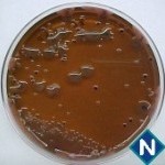 Imagem 3 - Ágar EMB