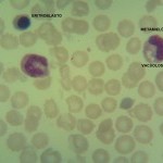 Foto da extensão sanguínea 6