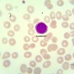 Foto da extensão sanguínea 10