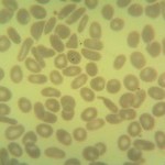 Foto da extensão sanguínea 2