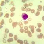 Foto da extensão sanguínea 7