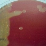 Figura 1 - Cultivo em ágar sangue