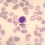 Foto da extensão sanguínea 1