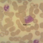 Foto da extensão sanguínea 2