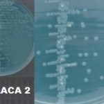 Imagem 2 - Urocultura - Amostra 2