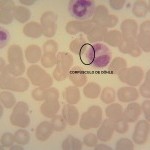 Foto da extensão sanguínea 1