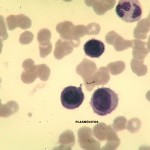 Foto da extensão sanguínea 4